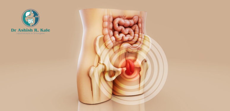 Best hernia surgeon in Pune