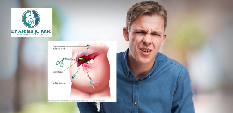 Best Laparoscopic Surgeon in Pune - Dr. Ashish Rasik Kale