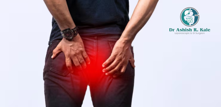 Fistula & Fissures Fistula Laser Surgery Treatment in Pune – Dr. Ashish Rasik Kale