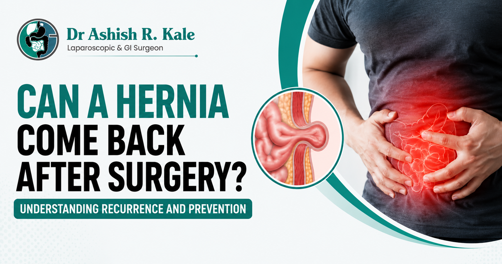 Can a Hernia Come Back After Surgery? Blog banner featuring Dr. Ashish R. Kale with a hernia illustration and abdominal pain image, optimized for the keyword Best Laparoscopic Hernia Surgeon.